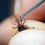 Kene ısırığıyla başlayan sendrom! Tükettiğiniz an öldürebilir