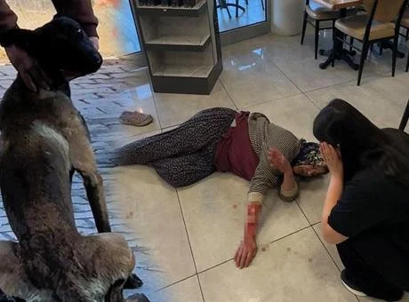 Dinlenme tesisinde can pazarı! Başıboş köpek kadının kolunu kopardı