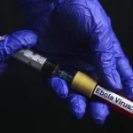Fransa’da Ebola alarmı! 21 günlük karantina süreci başladı