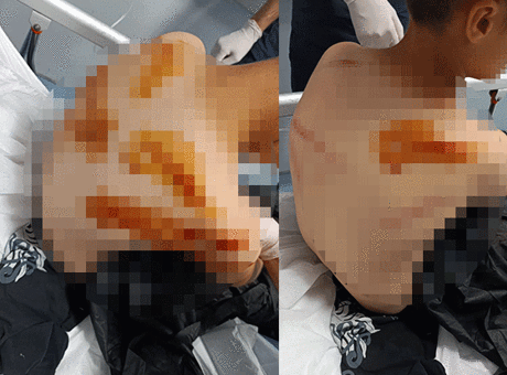 Şanlıurfa’da komşu dehşeti! 11 yaşındaki çocuğu sokak ortasında sopayla öldüresiye darbetti