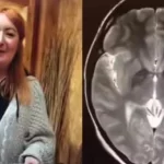 Hindistan gezisi sonrası kabusu yaşadı! Beyninde 38 adet tespit edildi