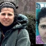 3 boyutlu teknoloji mucizesi! Alnındaki çöküklük tarih oldu
