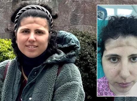 3 boyutlu teknoloji mucizesi! Alnındaki çöküklük tarih oldu